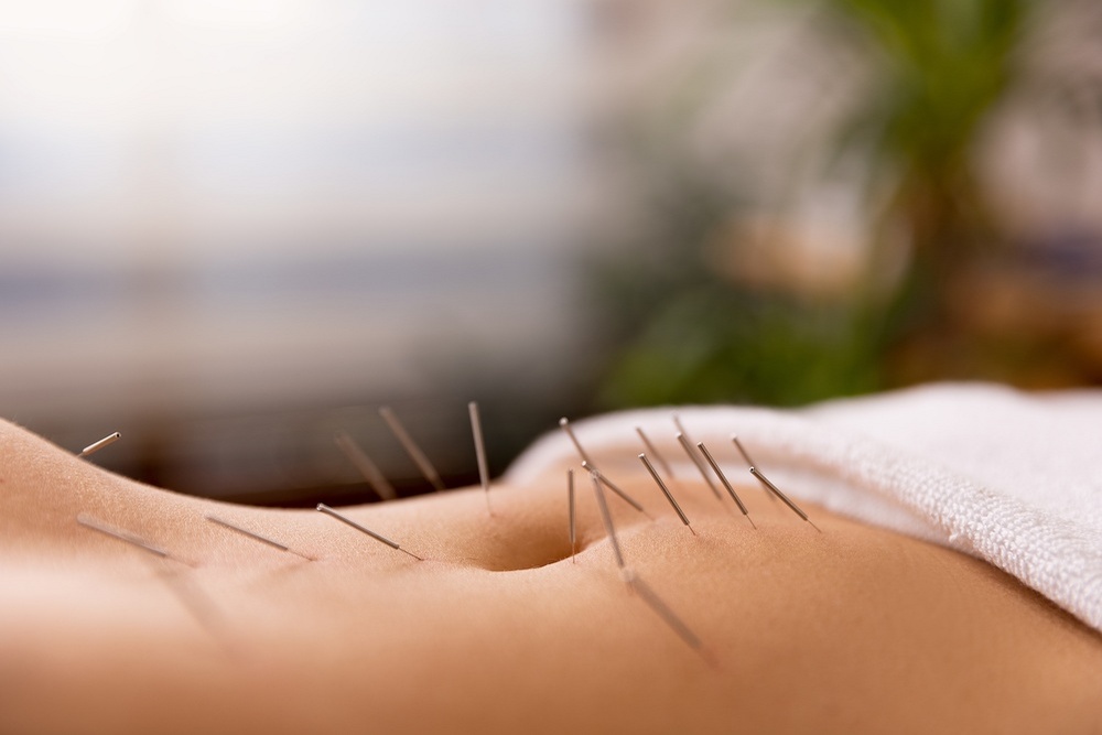 Digestive Health Support Through Acupuncture and Traditional Chinese Medicine